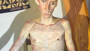 Přítel s anorexií